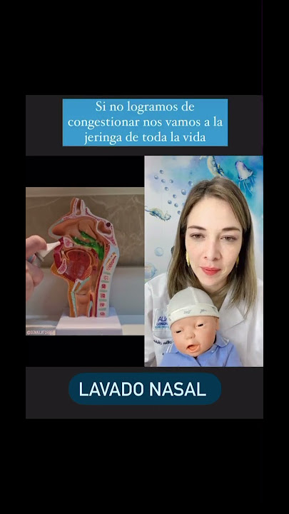 Lavado nasal con jeringa a mi bebé #lavadonasalenbebés #lavadonasalniñ
