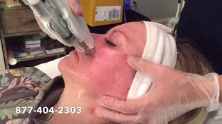 Meso Skin Therapy Facial Equipment + Nutrient Rich Serum Infusion + Beauty Oasis Rx + Gububella Rx