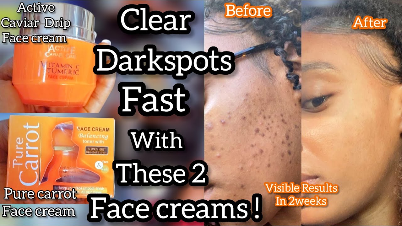 The ULTIMATE Routine for Dark Spots | Doctorly Hypermentation and ...