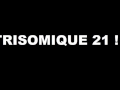 Musique trisomiques 21