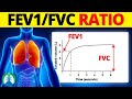 Fev1fvc ratio medical definition  quick explainer