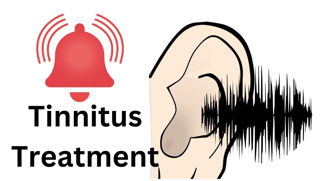 Ringing Ears Treatment YouTube