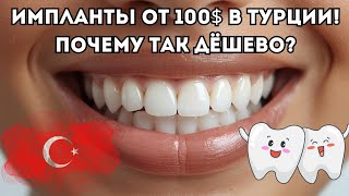 💎 Лечение зубов в Турции | Импланты и коронки от 100$ | Почему стоит лечить зубы в Анталии и Аланье