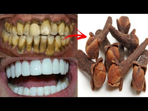 Teeth whitening and scaling in one minute! you will get teeth like pearls