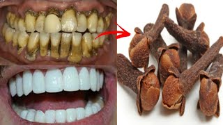 Teeth whitening and scaling in one minute! you will get teeth like pearls