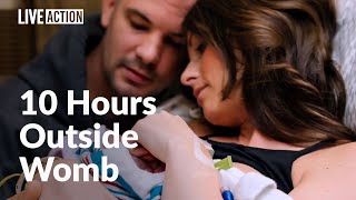 Parents Love And Care For Daughter With Anencephaly - Our Blessing, Our Grace