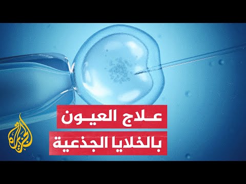 دراسة: إجراء لعلاج الإصابات البالغة في العين باستخدام الخلايا الجذعية للعين الأخرى