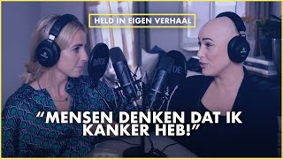 KALE KOP door ALOPECIA als VROUW