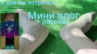 мини влог +рассказ (рассказываю как мне каректировали ногу) (показываю свои ноги)