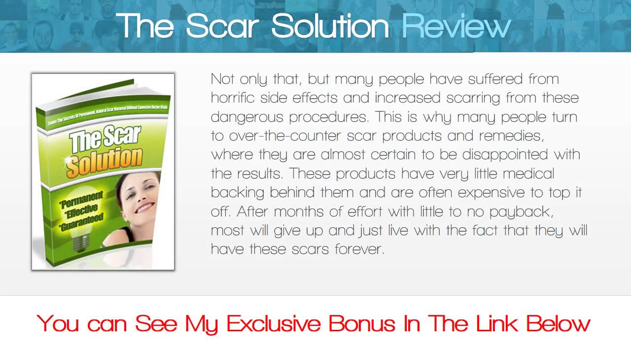 The Scar Solution Review get *BEST* Bonus HERE!!! ) ) ) YouTube