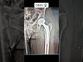 “Comment your answer NOW!”  #radiology #casestudy #xraycase