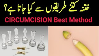 Circumcision Methods | Best Methods