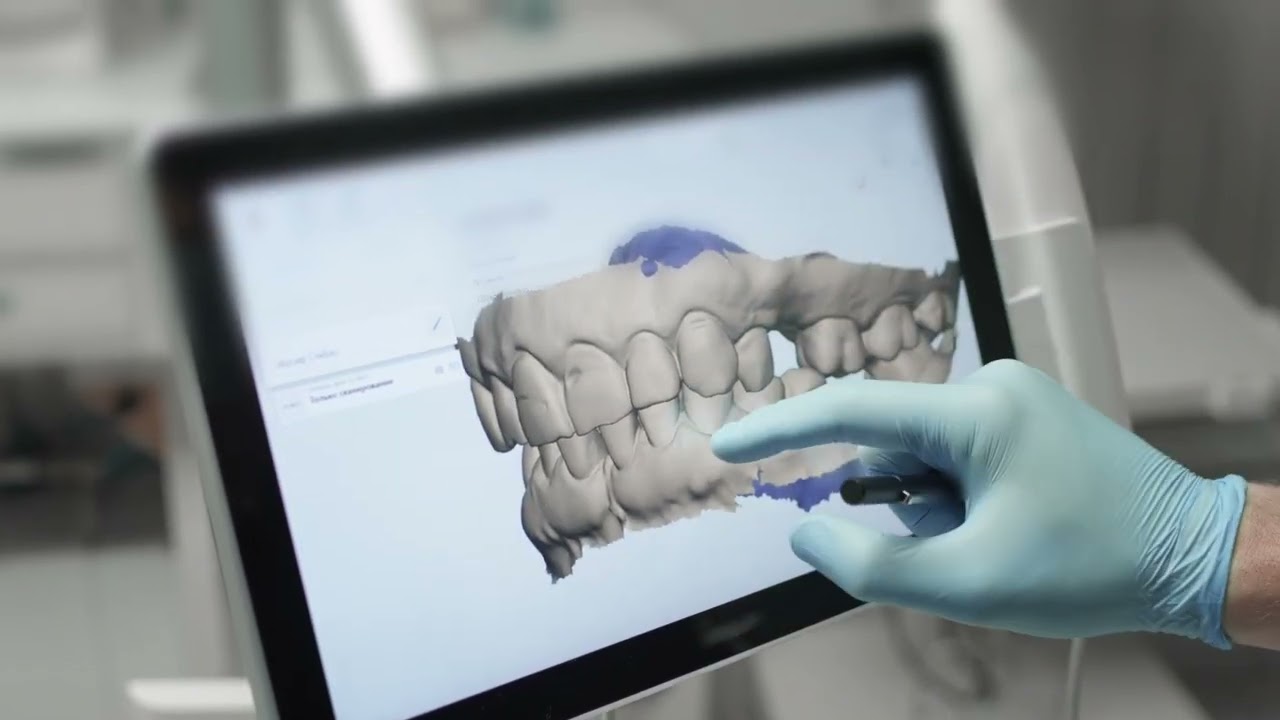 Hammaste proteesimine kaasaegse tehnoloogia abil