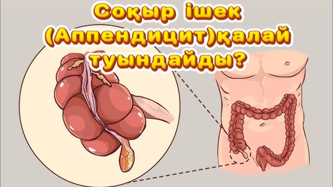 Сексуалдық киімдегі порно