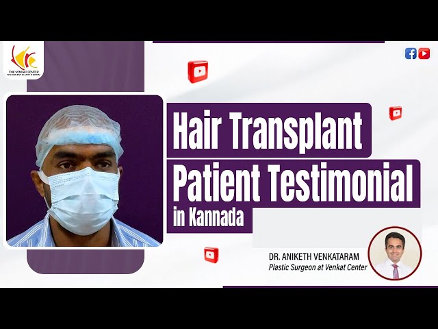 Hair Transplant Patient Review After the Surgery (in Kannada) | Venkat Centre Bangalore