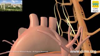 Heart Failure Overview - CIMS Hospital