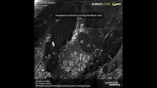 Toxoplasma infection in living fibroblast cells