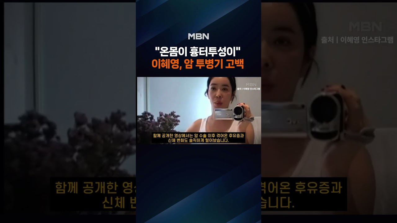 이혜영 "온몸에 상처와 흉터"…암 투병 후 근황 공개