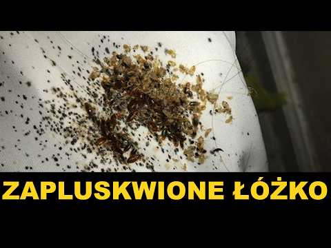 WALCZYLI JUŻ 3 LATA Z PLUSKWAMI-pluskwy jak się pozbyć - pluskwa domowa jak się pozbyć