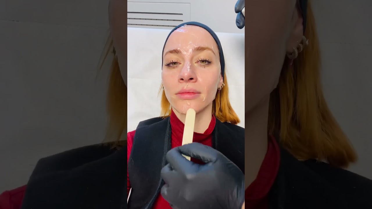 ADVATx: Il Laser Rivoluzionario per Trattamenti Indolori e Veloci