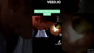 MAN HAS CATFISH STUCK IN THROAT #fypシ #fyp #viralshort #viral #viralvideo #youtubeshorts #funny