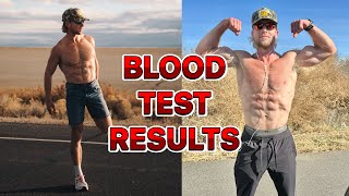 Blood Test Results