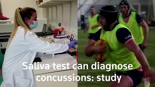 Saliva test can diagnose concussion, study says