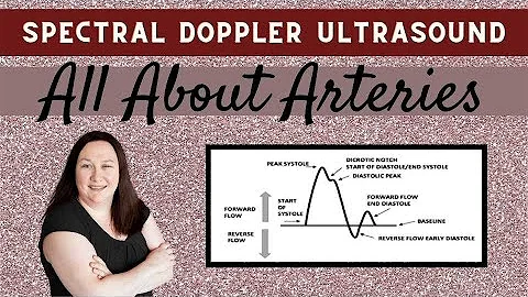 Spectral Doppler Ultrasound (All About Arteries)
