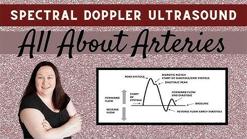 Spectral Doppler Ultrasound (All About Arteries)