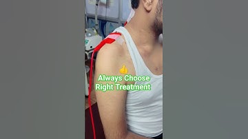 Brachial plexus injury treatment 👍 #unique #different #decision #ytshorts #viral