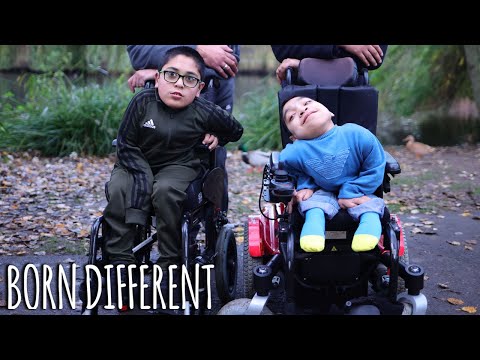 Cousins' Ultra-Rare Condition Makes Them 'Twins' | BORN DIFFERENT