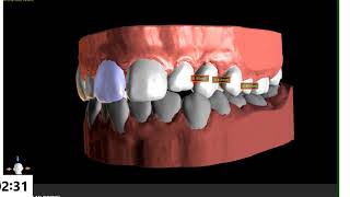 BlueSkyPlan 4.7 - New Video Overview