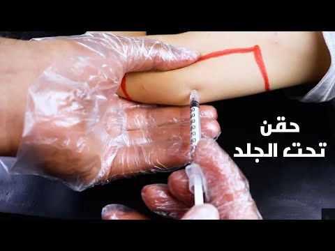 فيديو: كيفية اعطاء حقنة تحت الجلد (بالصور)