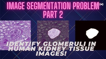 Image Segmentation Problem Using Deep Learning - PART 2
