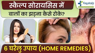 6 घरेलु उपाय: स्कैल्प सोरायसिस में बालों का झड़ना कैसे रोके? Hair Loss due to Scalp Psoriasis