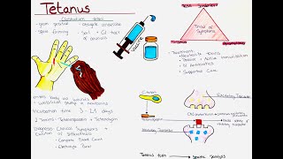 Tetanus (Clostridium tetani) - Microbio, Symptoms, Diagnosis, Treatment, Prevention etc.