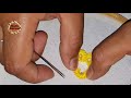 Hand Embroidery:Easy Amazing Needle Trick Flower,Hand Work Embroidery Latest Trick