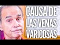 Episodio #1943 Causa De Las Venas Varicosas