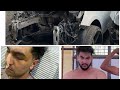 Accident da sach te yarr dost de sach te family ideep jattmind ideep1