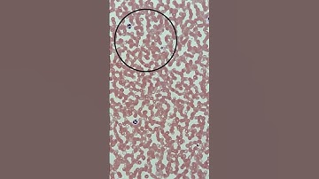 Malaria under the microscope 🩸🔬