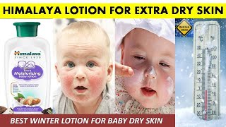 HIMALAYA BABY LOTION FOR DRY SKIN | HIMALAYA EXTRA MOISTURIZING LOTION | himalaya baby lotion