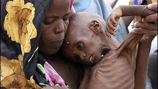 Yemen Crisis Around 85,000 Kids Die Of Starvation
