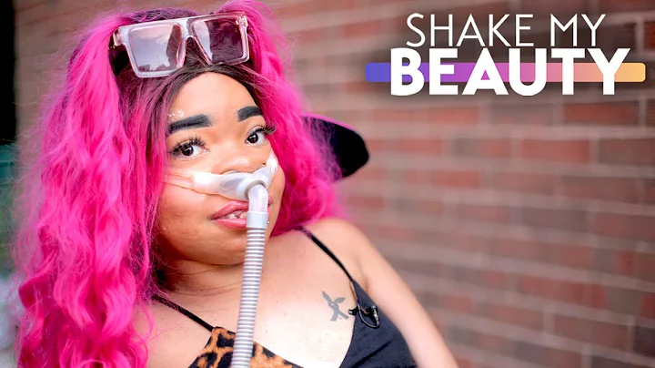 My 24/7 Ventilator Hasn't Stopped Me Modelling | S...