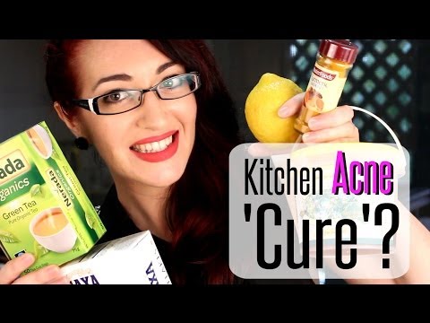 KITCHEN ACNE CURES?! DIY Natural Acne & Scarring Treatments At Home!