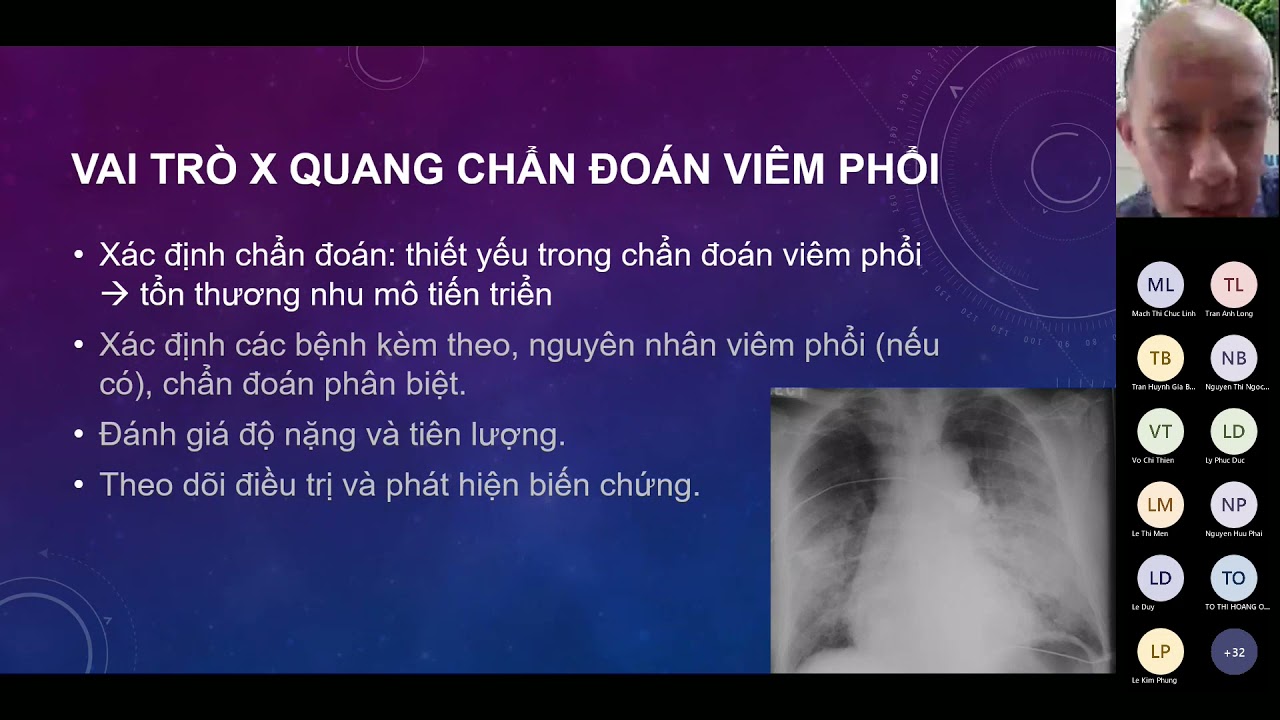VIÊM PHỔI