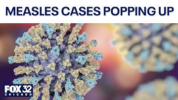 Measles cases popping up in more states across US