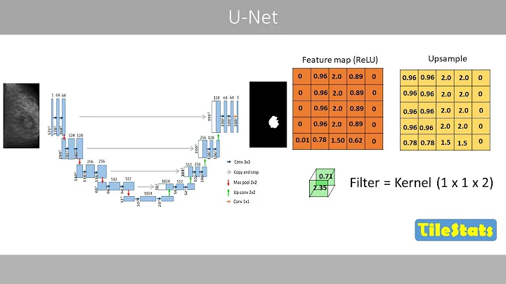U-Net clearly explained | Image Segmentation with AI