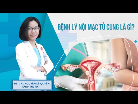 Video: 3 cách đối phó với các triệu chứng lạc nội mạc tử cung