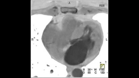 Cardiac: 4D reconstructions of heart motion (1 of 8)