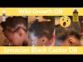 😲Wild growth hair oil before and after | Jamaican Castor Oil | Hair growth